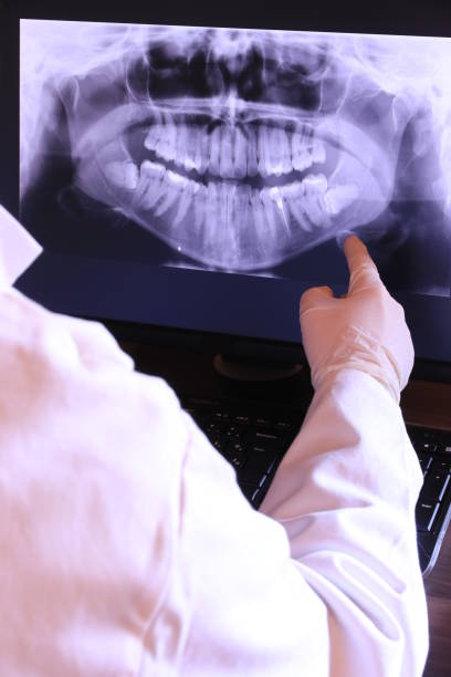 Best Chipped Tooth Repair Near Me  in Coal Valley, IL